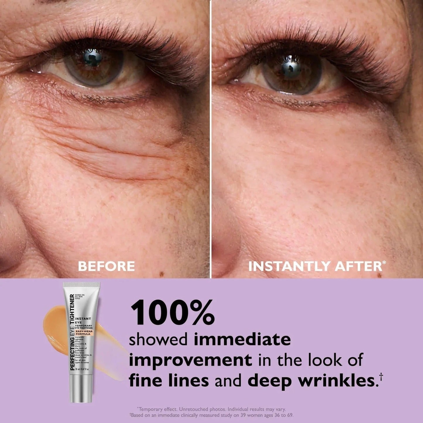 Instant Eye Tightener Easy-Wear Technology