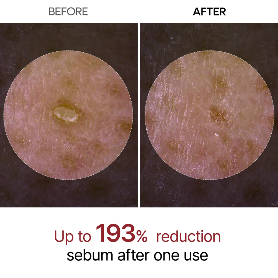 Peel Shot Glow White Rice Ampoule