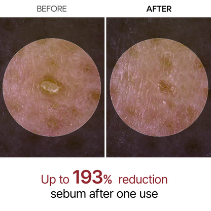 Peel Shot Glow White Rice Ampoule