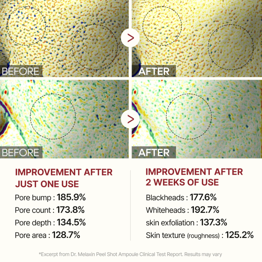 Peel Shot Glow White Rice Ampoule