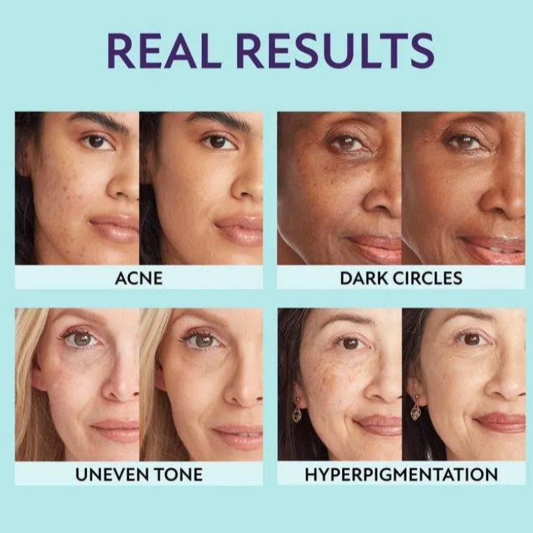 All-In-One Moisturizer, Concealer & Coverage